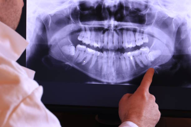 Best Knocked-Out Tooth Emergency  in Stoughton, WI